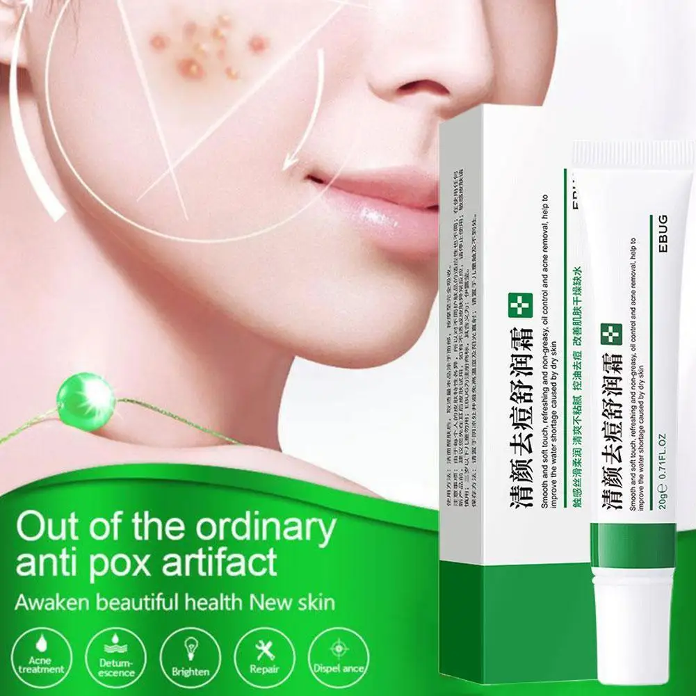 

Powerful Whitening Freckle Cream Remove Melasma Acne Melanin Spots Pigmentation Moisturizing Skin Dark Gel Spot Pigment Car S9m2