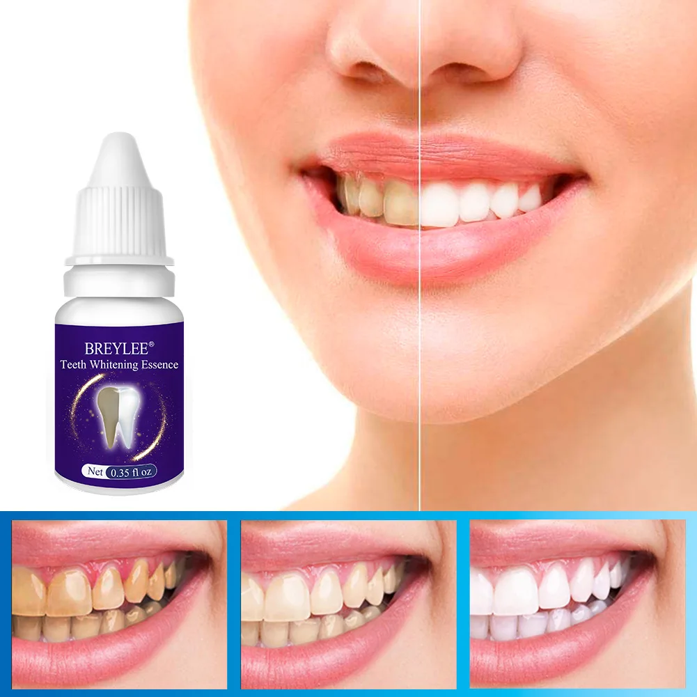 

Эссенция для отбеливания зубов BREYLEE, зубная паста, белая, для удаления зубного налета, пятен, отбеливания, гигиена полости рта, сыворотка для ...