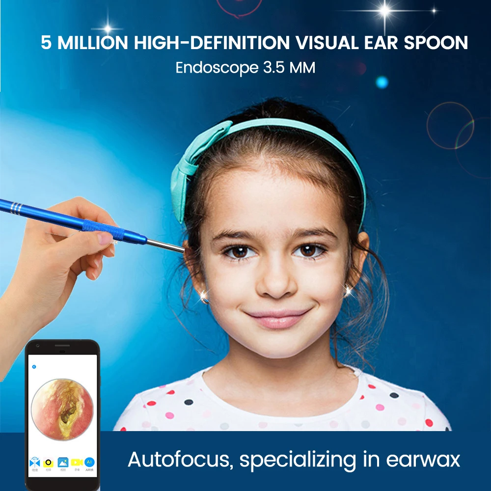 

Smart Ear Cleaner Stick with Endoscope High Precision Wireless Earwax Remover Set Rechargeable Otoscope Cleaning Tools