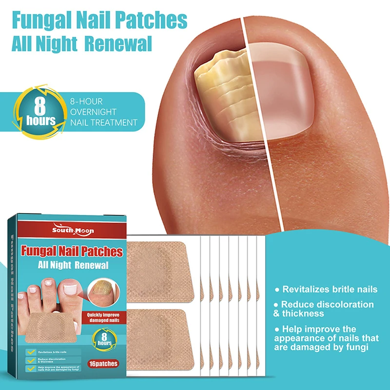 

16Pcs Nail Treatment Patch Anti Fungal Nail Correction Stickers Ingrown Toenail Care Paronychia Anti Infection Repair Patch
