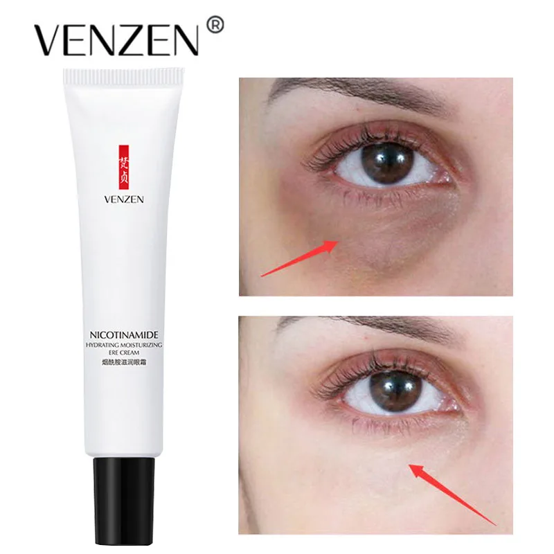 

20g Nicotinamide Eye Moisturizing essence Whitening Black Eye Circle Removing Hyaluronic Acid Eye Cream under Eye Bags