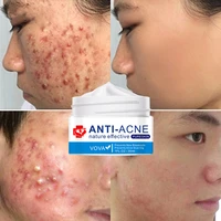effective acne removal cream herbal treatment acne spots oil control lighten acne marks scars shrink pores moisturizer skin care