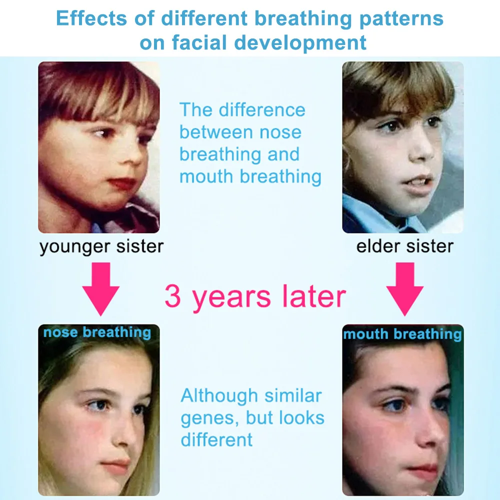 360 шт. лента-пробка для ночного дыхания и спящего храпа |