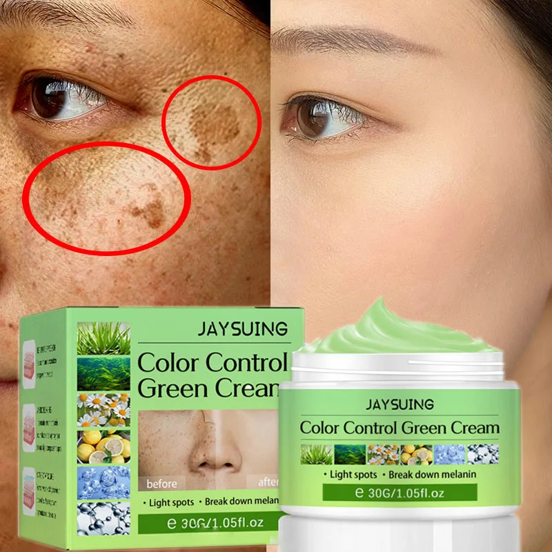 Whitening Freckles Cream Remove Melasma Dark Spot Lightening Melanin Brighten Melasma Remover Moisturize Anti-aging Skin Care