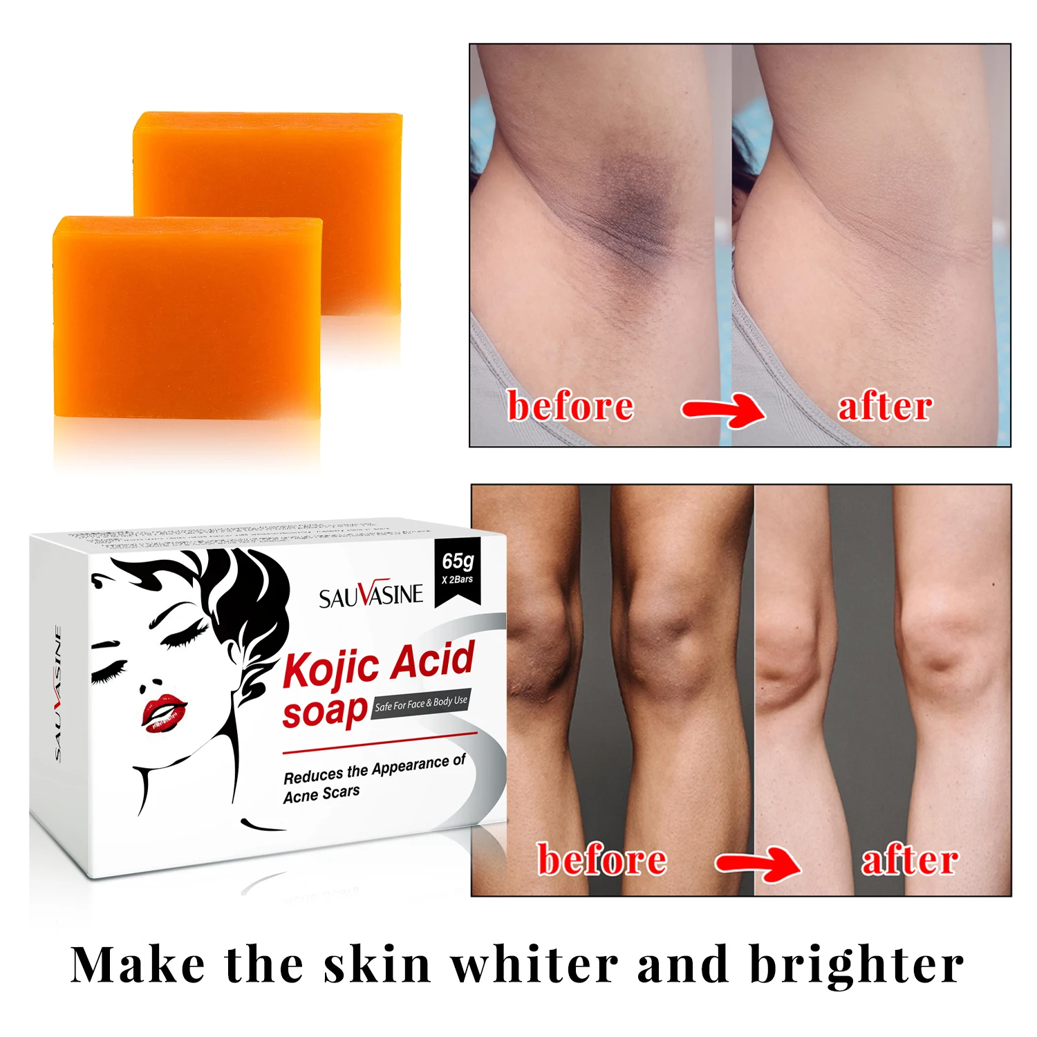 

Kojic Acid Soap Inhibit Melanin Formation Remove Black Spots Improve Skin Tone Original Whitening Hand Soap Brightening