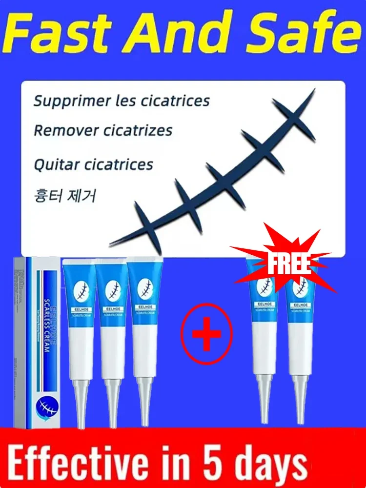 Крем для беременных удаление растяжек красных и белых старых