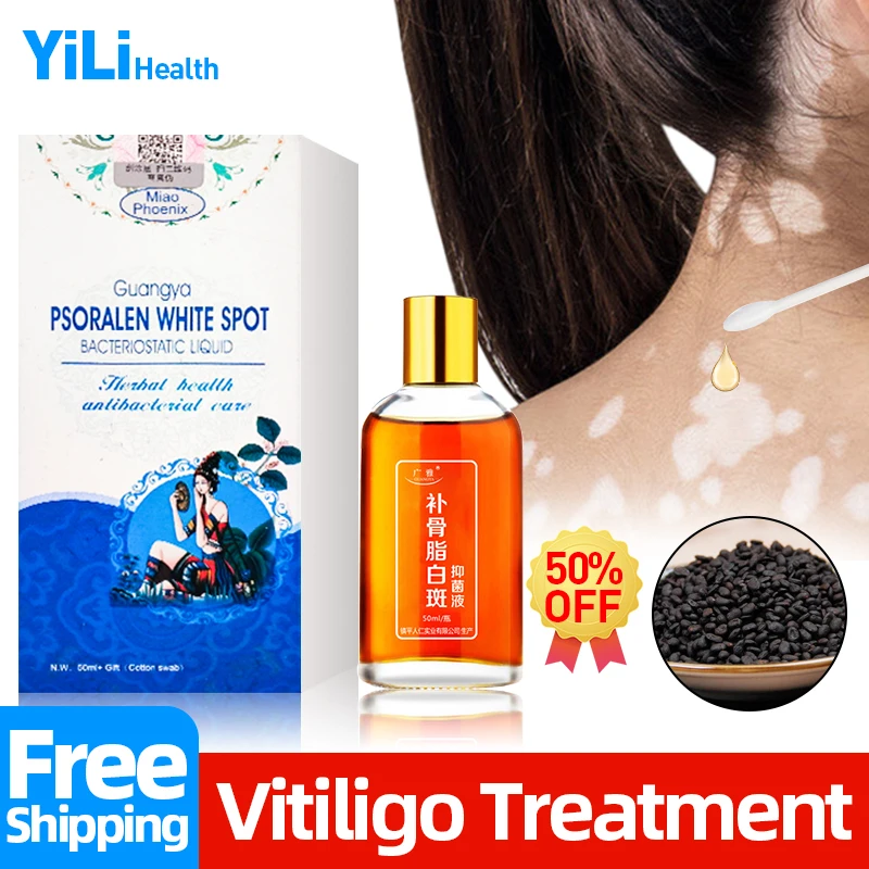 

Vitiligo Treatment Medicine Liquid White Spot Cure Leukoplakia Disease Promoting Skin Melagenina Health Care
