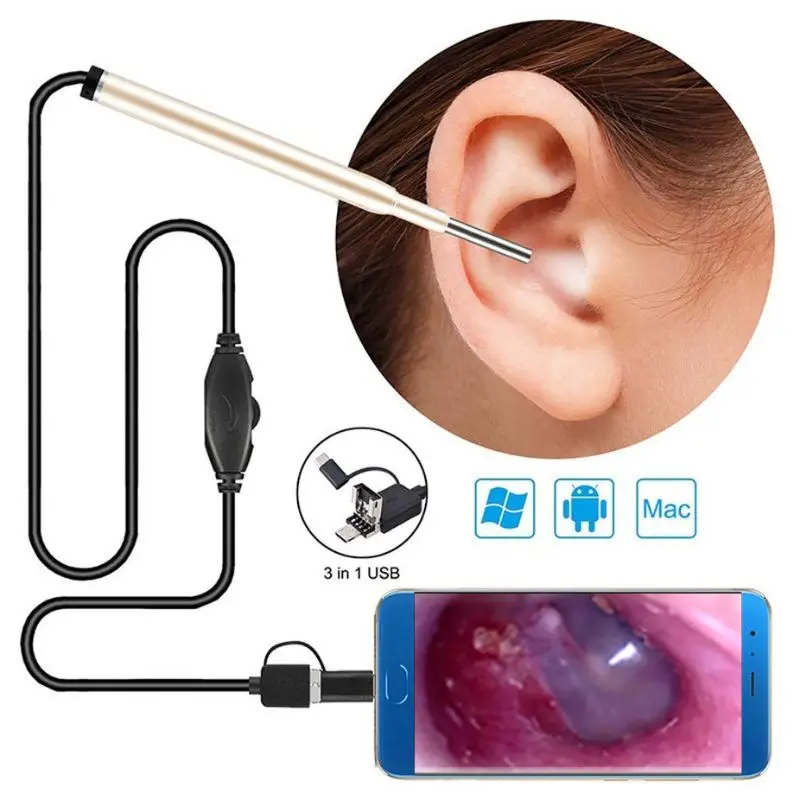 

XGKHUT USB эндоскоп для ушей