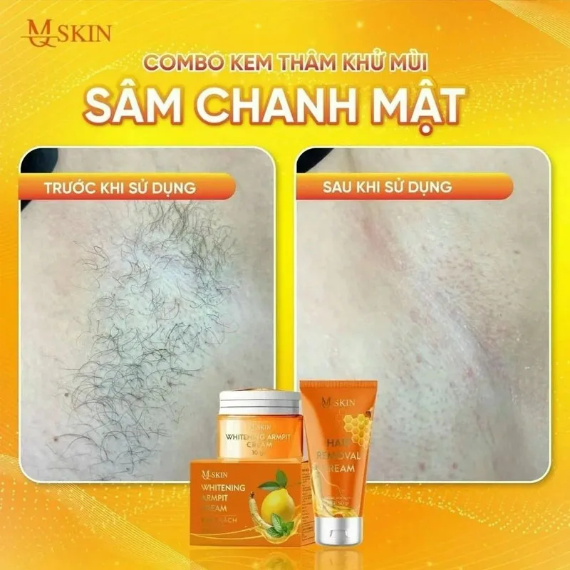 Combo Kem Thâm Nelea Kh Leit Membali Sâm Chanh Mır + Wax L deenndar Phembali MQ Skin White Remove Odor KEM THAM KHU MUI SAM CHANH MAT