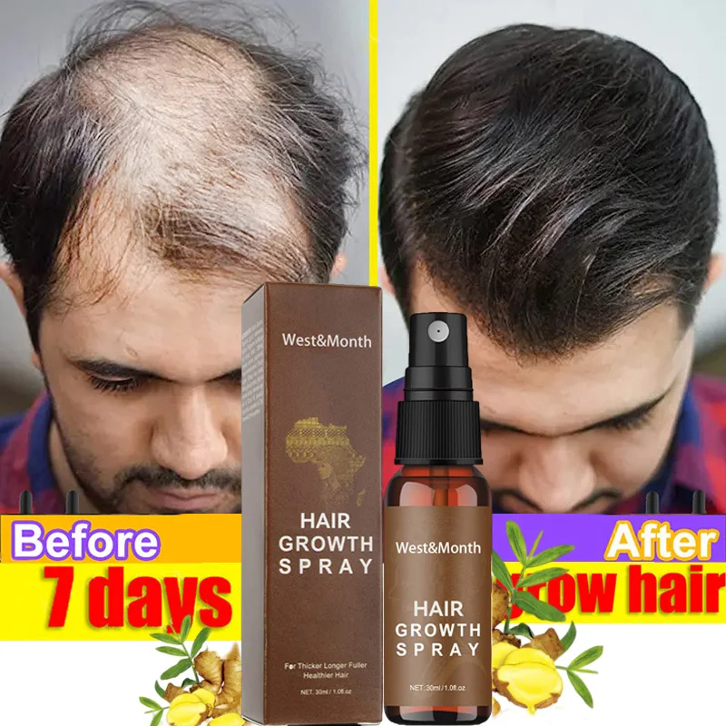 

Hair Growth Serum Spray Ginger Prevent Hair Loss Essence Fast Regrowth Hair Repair Nourish Hair Roots Scalp Treatment Men Women