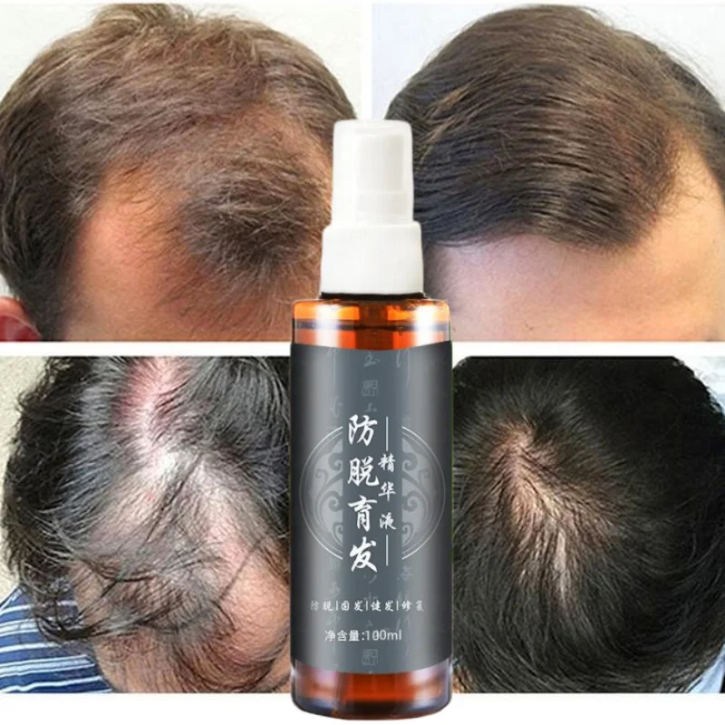 

100ml Powerful Hair Growth Serum Spray Anti Hair Loss Treatment Essence Oil Repair Nourish Hair Roots Regrowth Hair for Men Wome