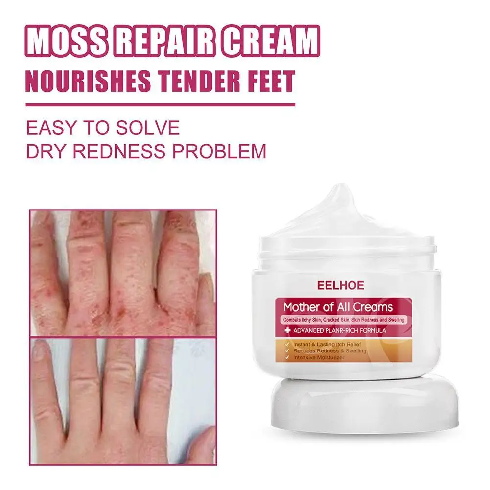 

EELHOE Hand And Foot Moisturizing Repair Cream Skin Moss Repair Relieve Itching And Relieve Itching Hydrating Moisturizing And N