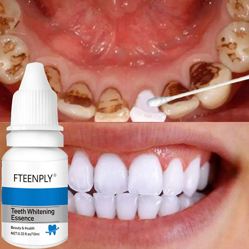 

Teeth Whitening Essence Remove Plaque Stains Yellow Teeth Bleaching Serum Fresh Breath Cleaning Oral Hygiene Care Dental Tools