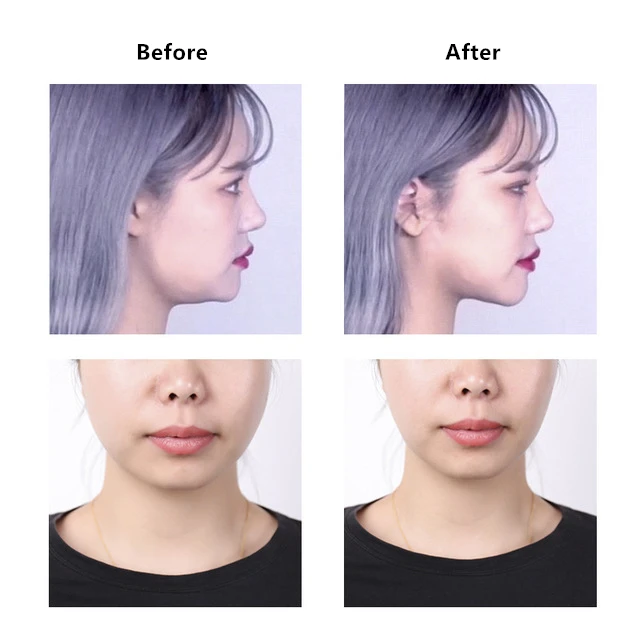 

2022 New 40Pcs Invisible Thin Face Stickers Facial Line Wrinkle Sagging Skin V-Shape Face Lift Up Chin Adhesive Tape Tools