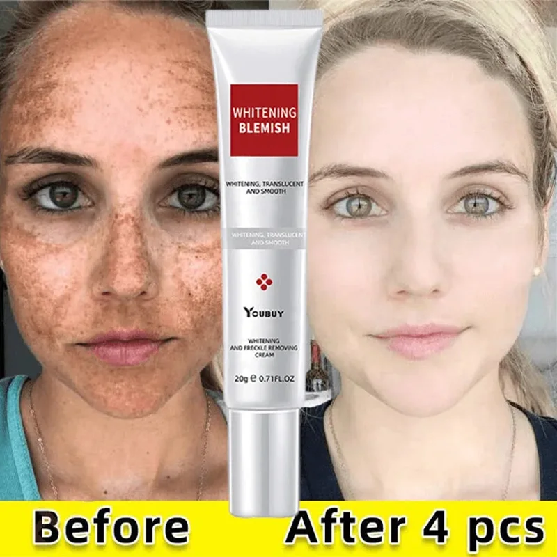 Whitening Face Cream Effective Freckle Remove Acne Spots Melanin Dark Melasma Brightening Repair Anti-Aging Korean Skin Care 20g