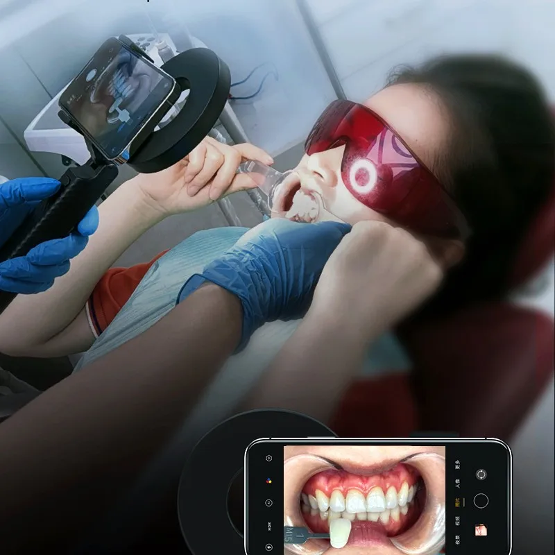 Фонарь-вспышка VV Dental для фотосъемки с 18 светодиодами высокой яркости, источник света для камеры смартфона (art.: 3920dabc3b4fa) - 3920dabc3b4fa
