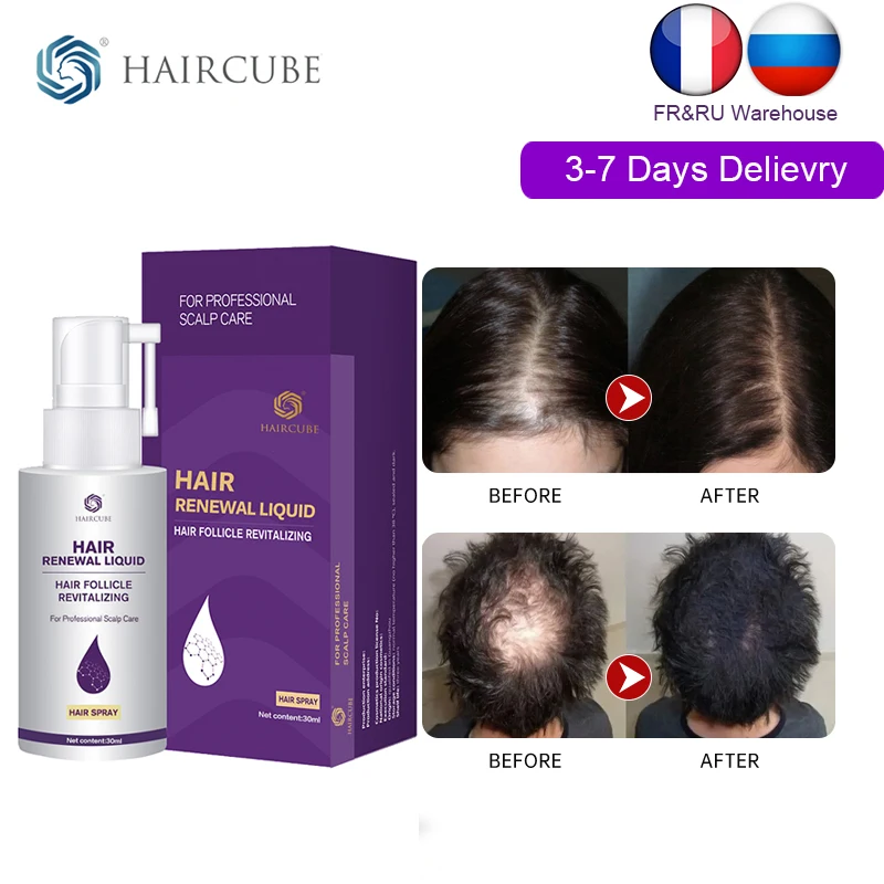 Hair Growth Product for Men/Women Anti Hair Loss Treatment Ginger Hair Regrowth Spray Repair Damaged Hair Roots Essence Original