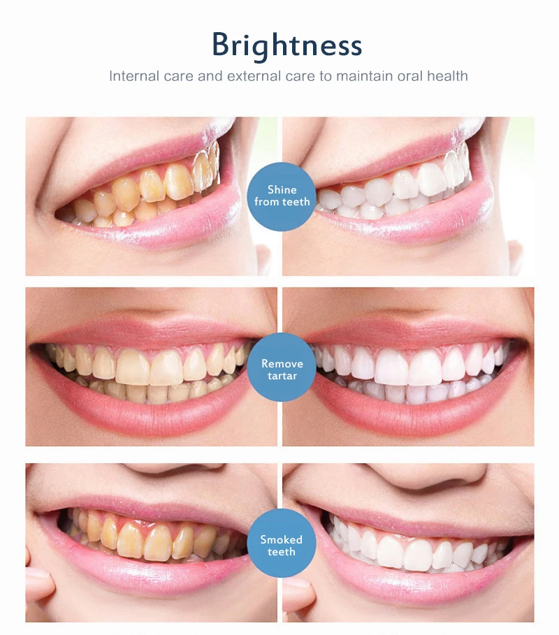Горячая пена для отбеливания зубов с пастой для зубов, содержащей пищевую соду, для чистки зубов, свежести и блеска полости рта, удаляющая зубной налет и пятна.