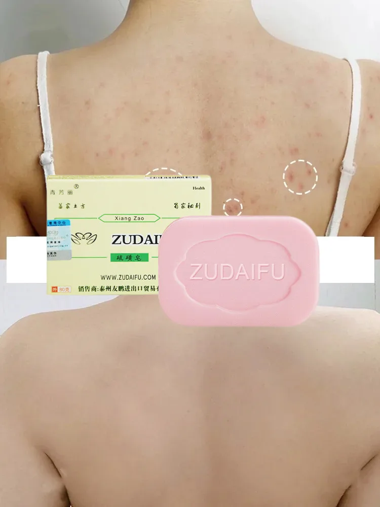 

3Pcs ZUDAIFU Sulfur Soap Oil Control Cleaning Skin Health Care Suitable For Adults 80G Clean Face And Body