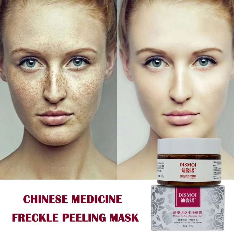

Chinese Medicine Freckle Cream Whitening Skin Care Peeling Mask Repair Cleaning Hydrating Skin Rejuvenating Facial Cream