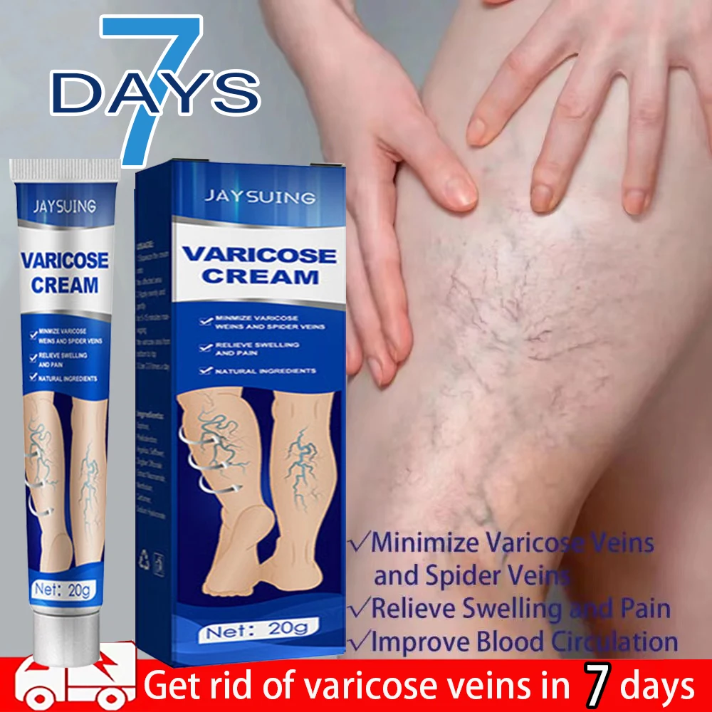 

Effective Varicose Vein Relief Cream Ointment For Varicose Veins To Relieve Vasculitis Phlebitis Spider Pain Treatment