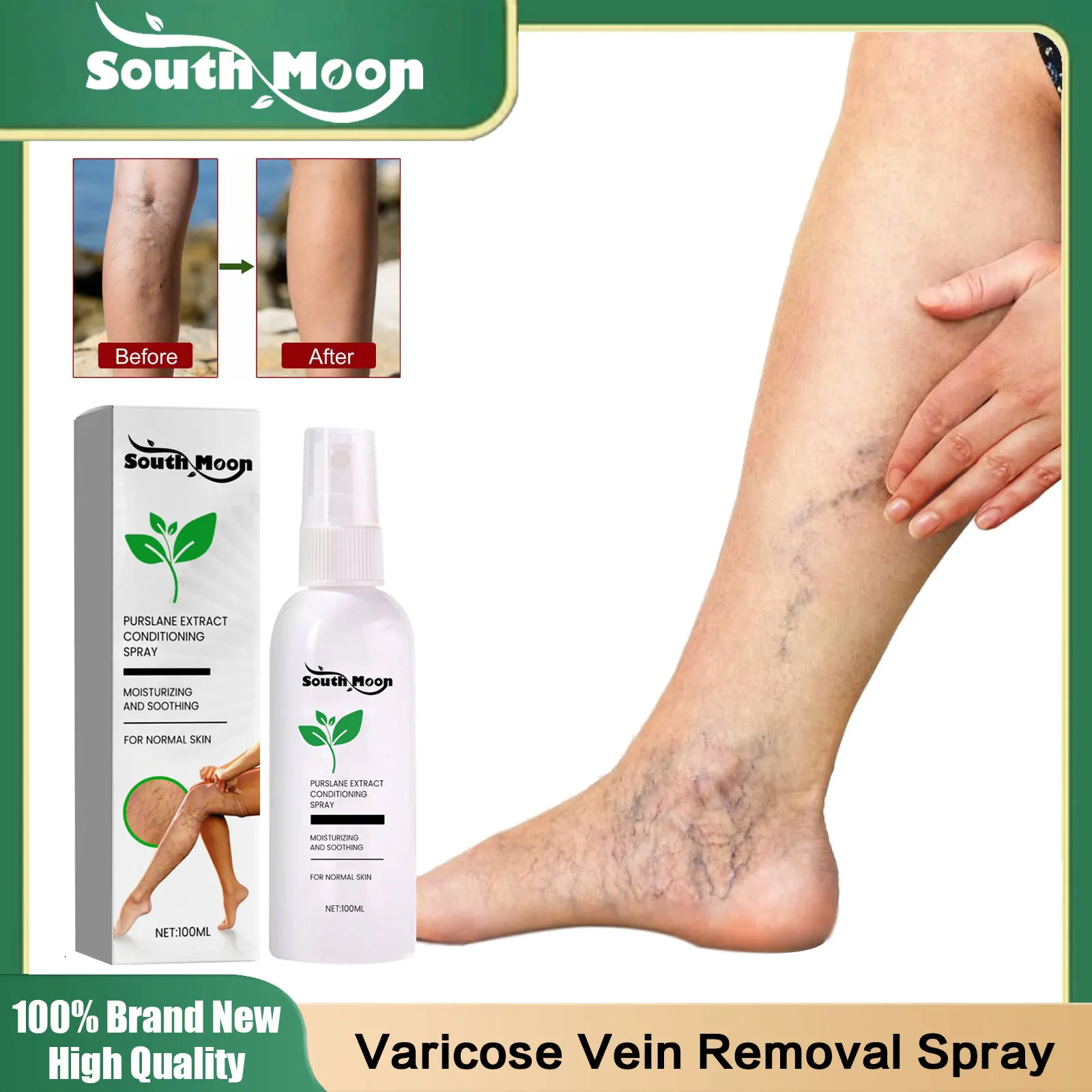 Спрей для удаления варикозного расширения вен паук облегчения боли устранения