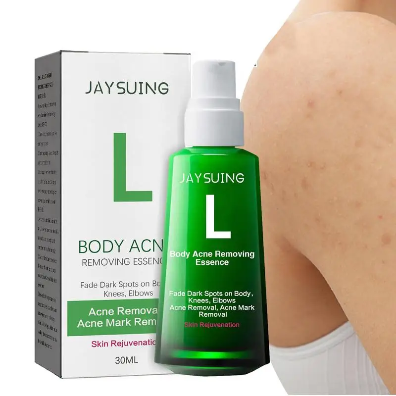 

Увлажняющая эссенция для удаления акне, 30 мл