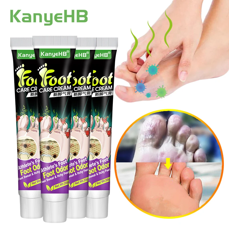 

1-2-4pcs Foot Beriberi Treatment Cream Anti-itch Inhibits Fungus Treats Foot Odor Tinea Pedis Athlete Foot Care Medical Ointment