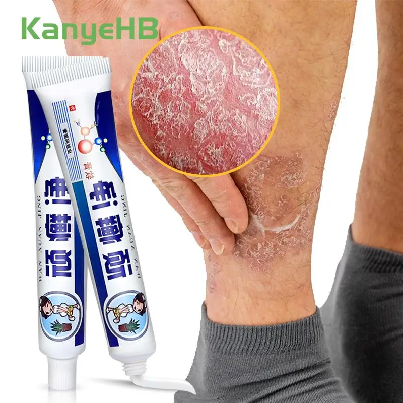 

2PC Original Psoriasis Cream Powerful Treatment Dermatitis Eczematoid Quick Sterilization And Itching Relieving Cream A256