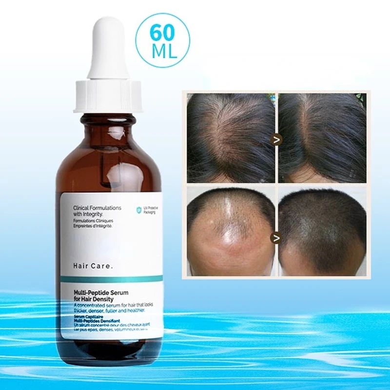60ml Hair Growth Essential Oil Original Authentic Care Essence Hair Loss Liquid Ordinary Peptide Treatment Beard Growth Serum