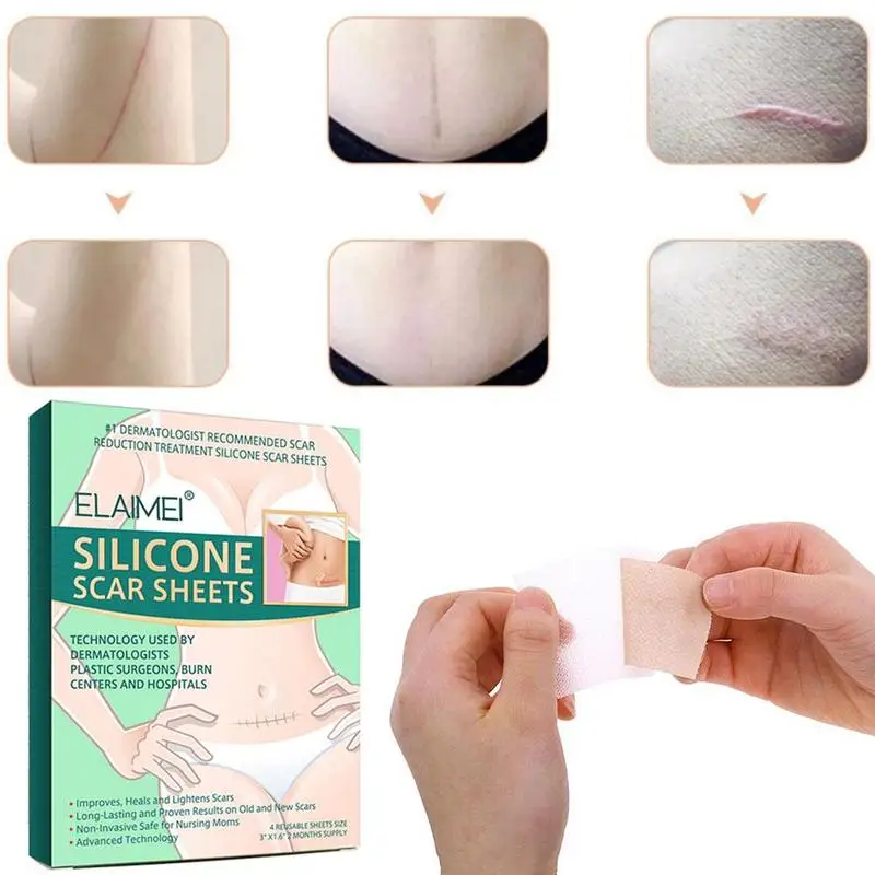 

Reusable Silicone Scar Sheets Removal Patch Acne Gel Therapy Repair Remove Silicon Patch Burn Skin Trauma Sheet Scar