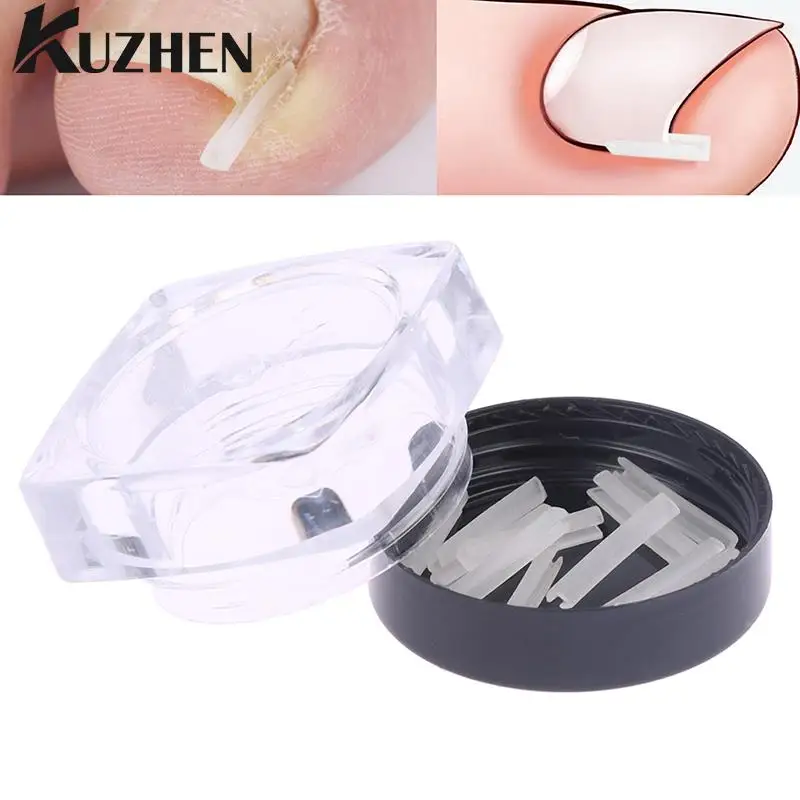 

10 шт., ортопедические вкладыши для выпрямления ногтей