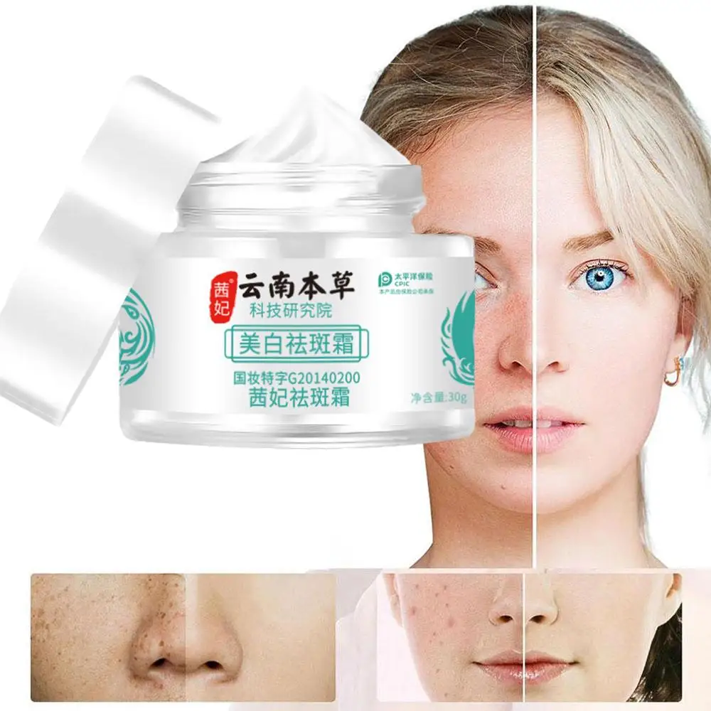 

30g Yun Nan Herb Powerful Whitening Freckle Cream Remove Dark Facial Moisturizing Spots Acne Cream Skin Brighten Fa B1X0