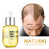 hair growth essence thickener regrowth serum treatments oil fast grow hair for hair loss care products men and women