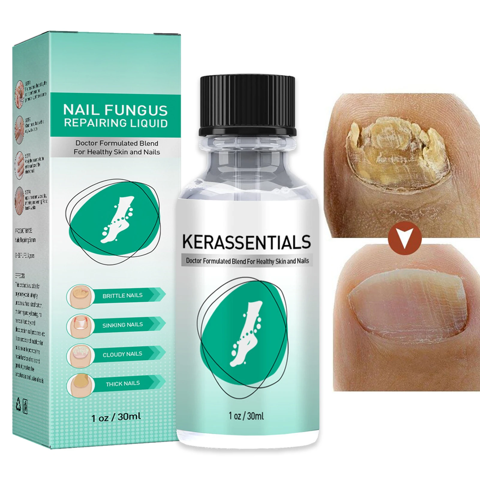 

Восстанавливающее масло для ногтей, безопасный лосьон для укрепления ногтей, Масло для кутикулы для роста ногтей для женщин, масло для роста ногтей с максимальной силой для