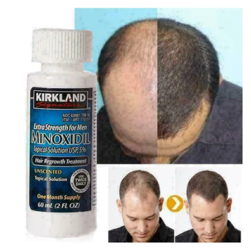 

60ml Kirkland Signature 5% Extra Strength Hair Regrowth Treatment For Men Male Man 2 FL.OZ