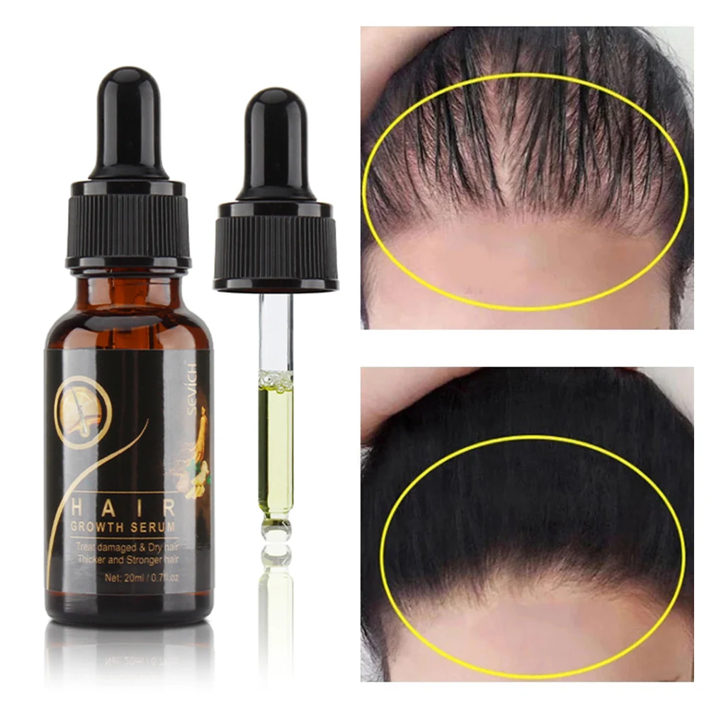 

20ml Hair Growth Serum Essence Damaged & Dry Hair Repairing Nourishing Essence Prevent Hair Loss Hair Growing Treatment Serum