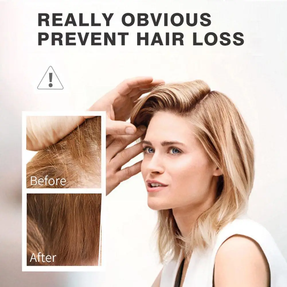 

20ml Effective Fast Growth Hair Care Essential Oils Q Baldness Z Repair U4v6 Prevent Z1j9