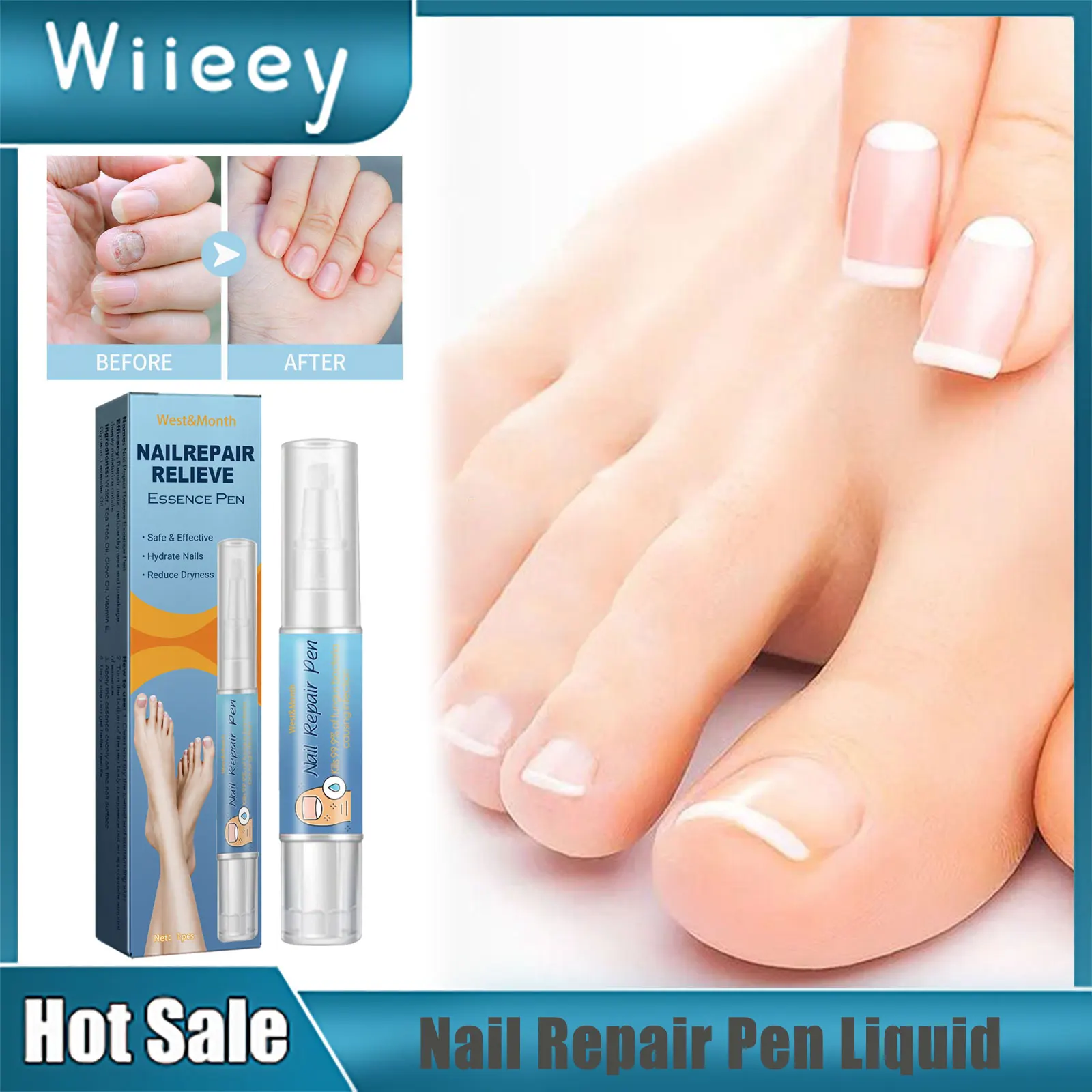 

Nail Repair Pen Liquid Paronychia Infection Hand Foot Toe Treatment Fungus Removal Nourishing Brighten Anti Onychomycosis Liquid