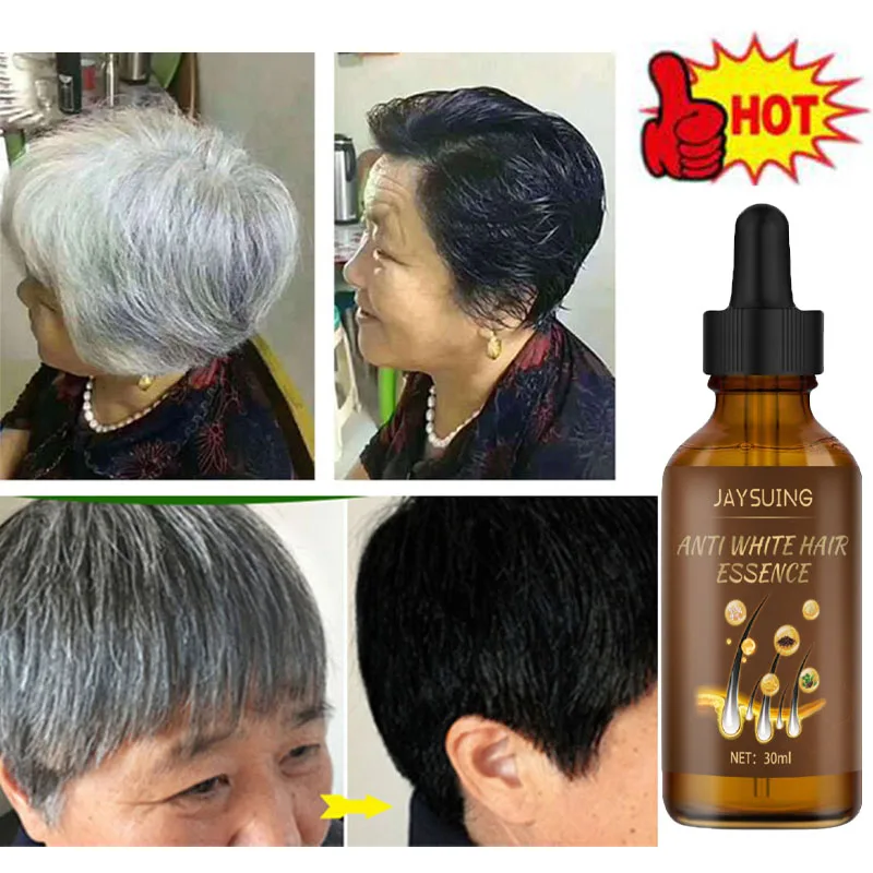 Effective Gray White Hair Treatment Serum Liquid Natural Color Repair Anti Loss Hair Care Scalp Nourish Product Men Women 30ml