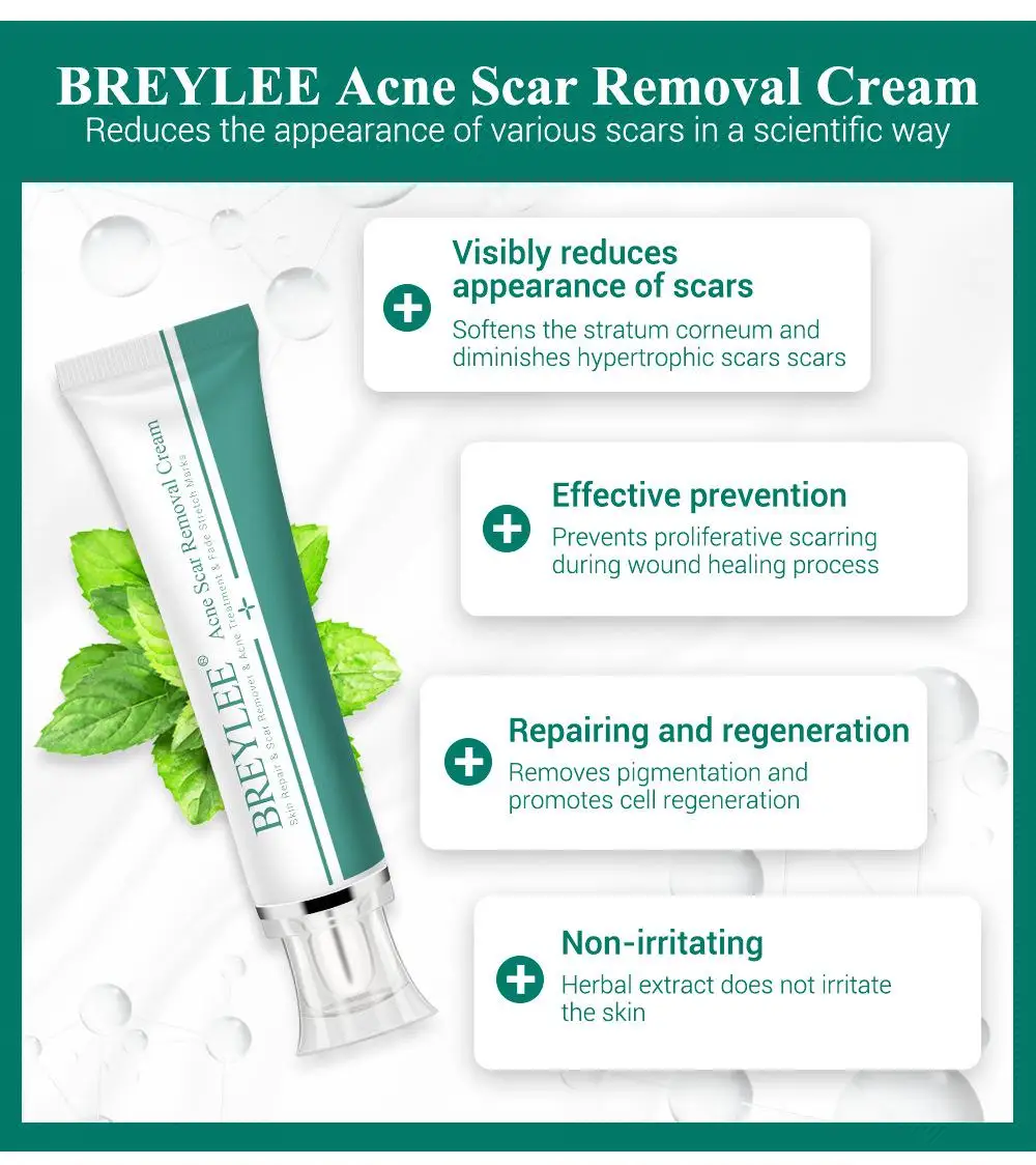 

1~5PCS 30g Fade Scar Stretch Marks Remover Cream Skin Repair Face Cream Acne Spots Acne Blackhead Whitening Cream Skin