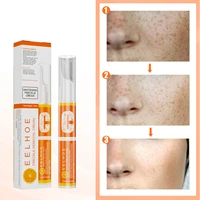 instant blemish removal gel whitening freckle pen moisturizing skin spots lifting removal freckle pigmented melanin 15ml