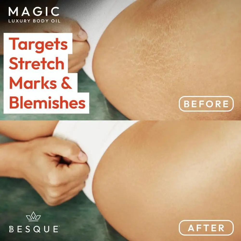 100 мл Besque Magic Body Oil плавное увлажнение расслабляющее антицеллюлитное масло для