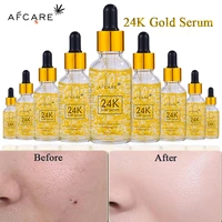new 24k gold face serum niacinamide essence moisturizing anti agingwrinkle hyaluronic acid shrinks pores repairs dry loose skin