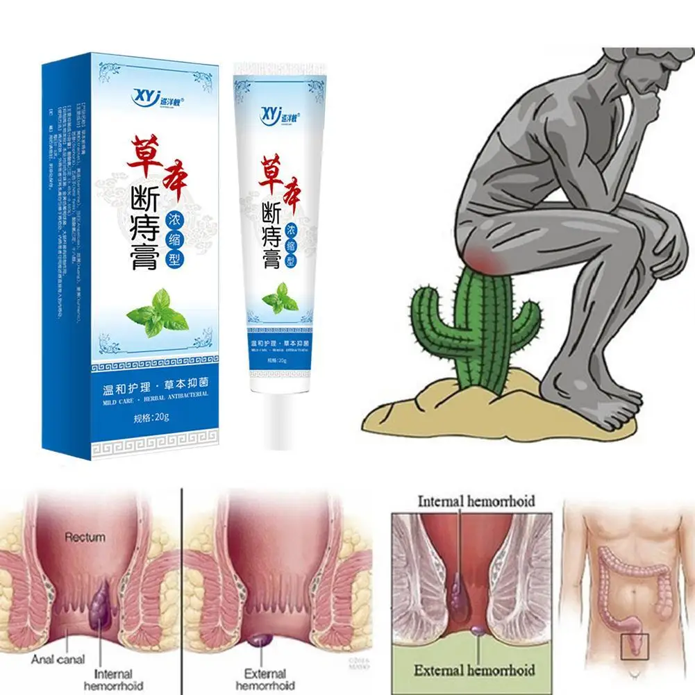 20 г травяная мазь от геморроя внутренняя и внешняя крем для анальной трещины