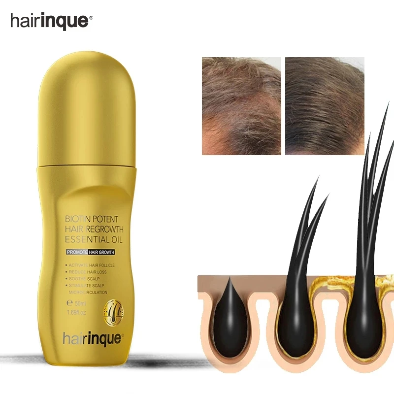 

Hairinque 50ml Vitamin B7 Fast Hair Growth Products Prevent Hair Loss Serum Scalp Treatments Growing Hair Care Oil for Men Women