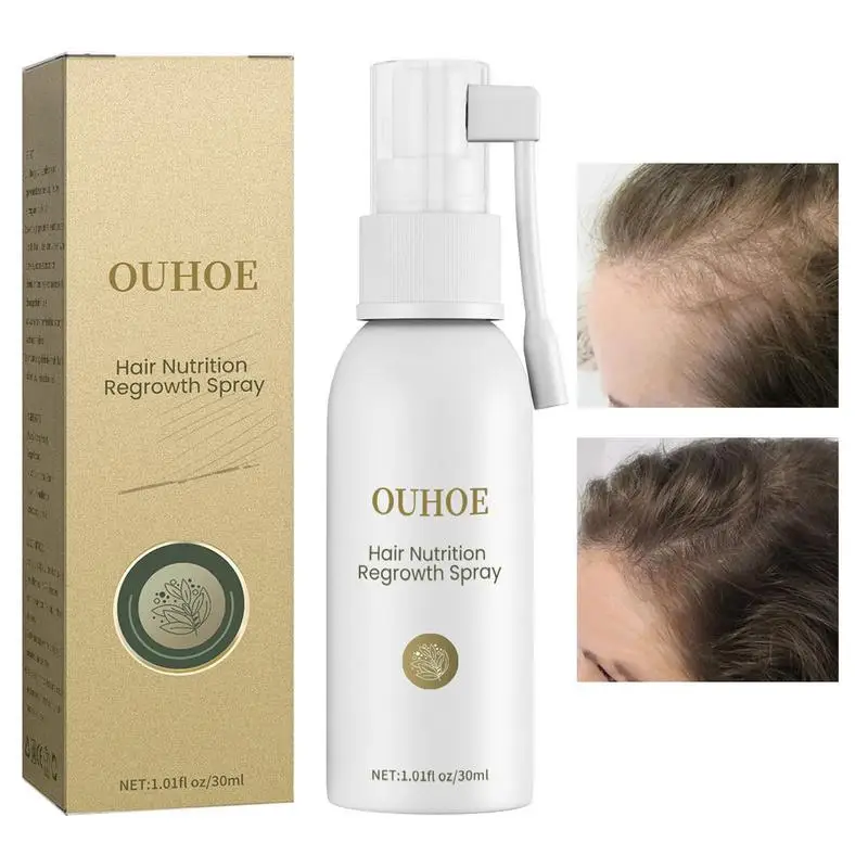 

Спрей для роста волос, 30 мл