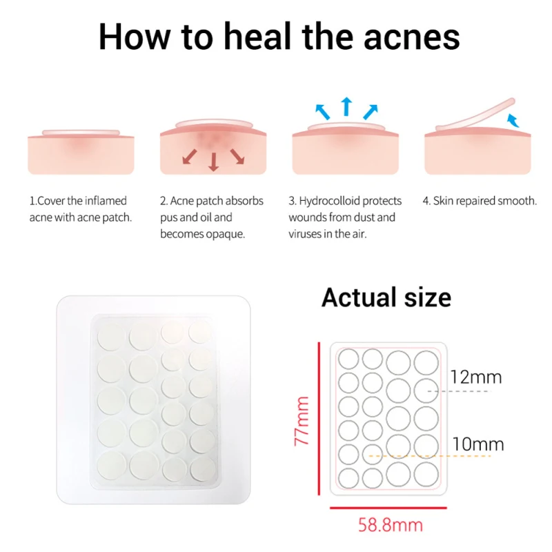 1-5 шт. водостойкая маска для удаления прыщей и