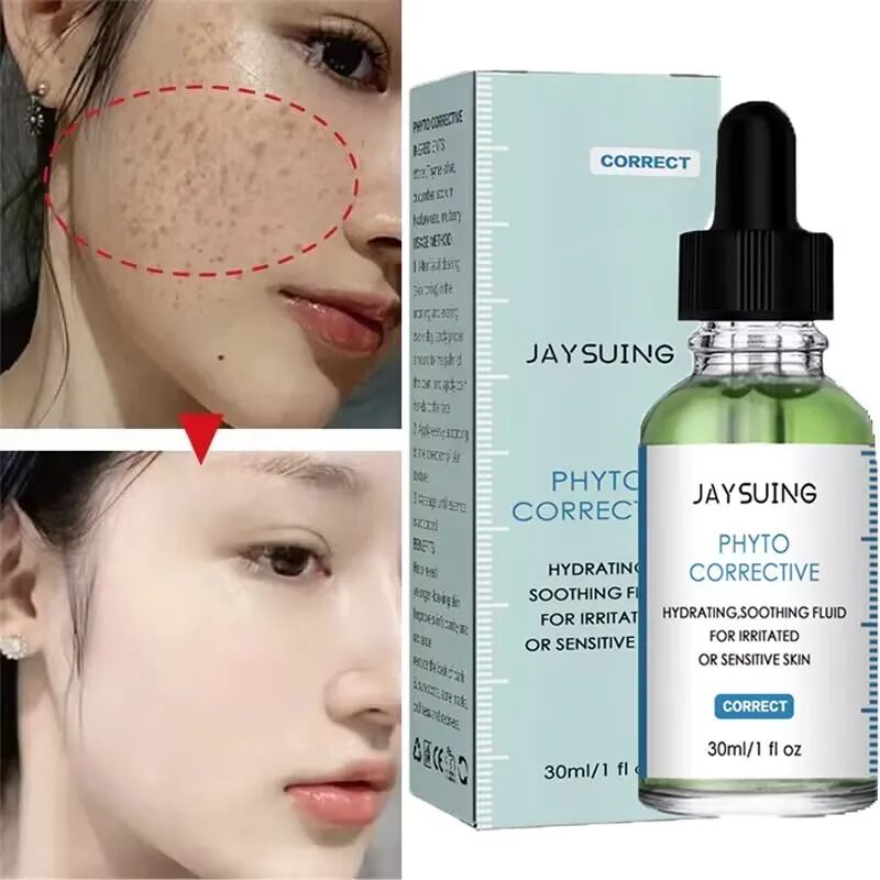 

Freckle Removal Whitening Face Serum Remove Dark Acne Spots Melasma Fade Melanin Moisturizing Brighten Nourish Beauty Skin Care