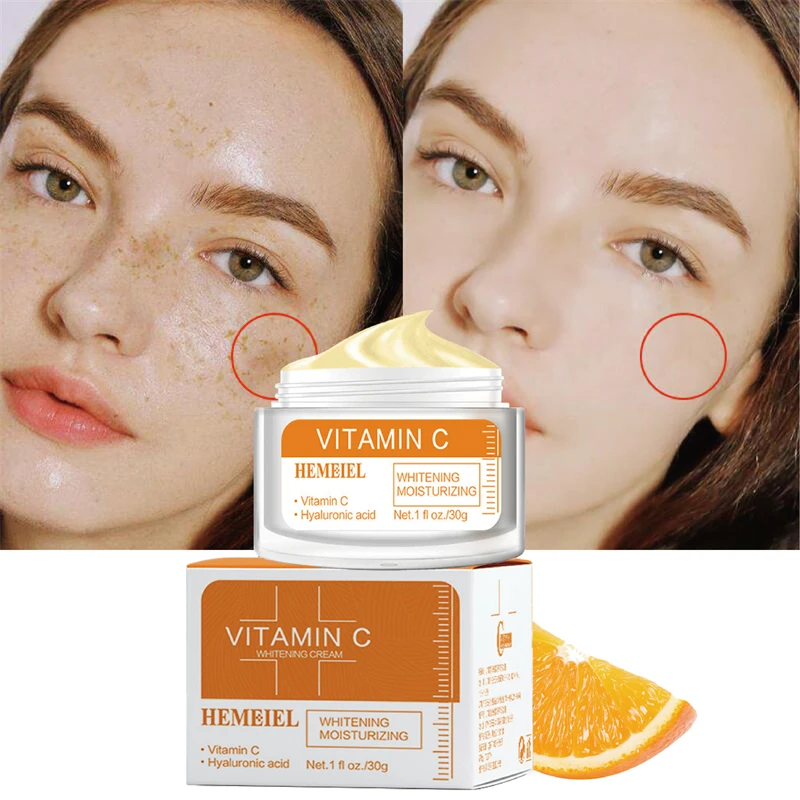 

Vitamin C Face Cream Whitening Freckle Cream Lift Firm Anti-aging Fade Fine Line Moisturizing Essence Brighten Repair Skin Care